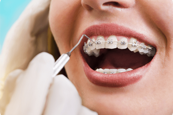 What-is-Orthodontic-Treatment-min